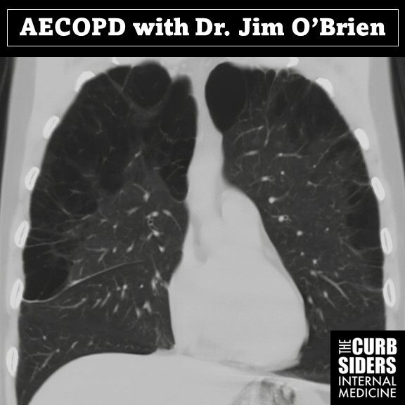 #378 Acute Exacerbations of COPD (AECOPD)